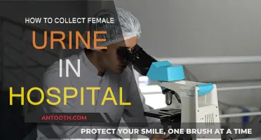 Collecting Female Urine Samples: A Guide for Hospitals
