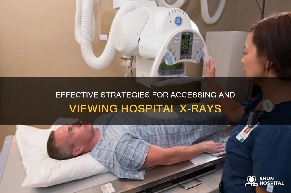 how to communicate with hospitals to see their x-rays