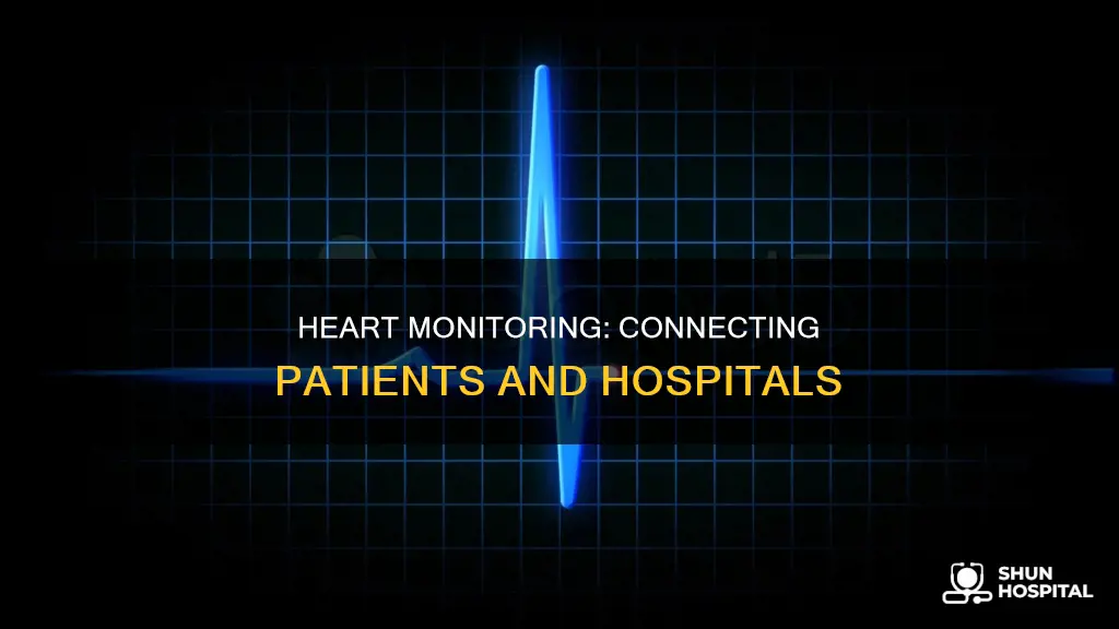 how to connect monitor heart for hospital
