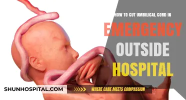 Emergency Umbilical Cord Cutting: A Step-by-Step Guide for Outside Hospital Settings