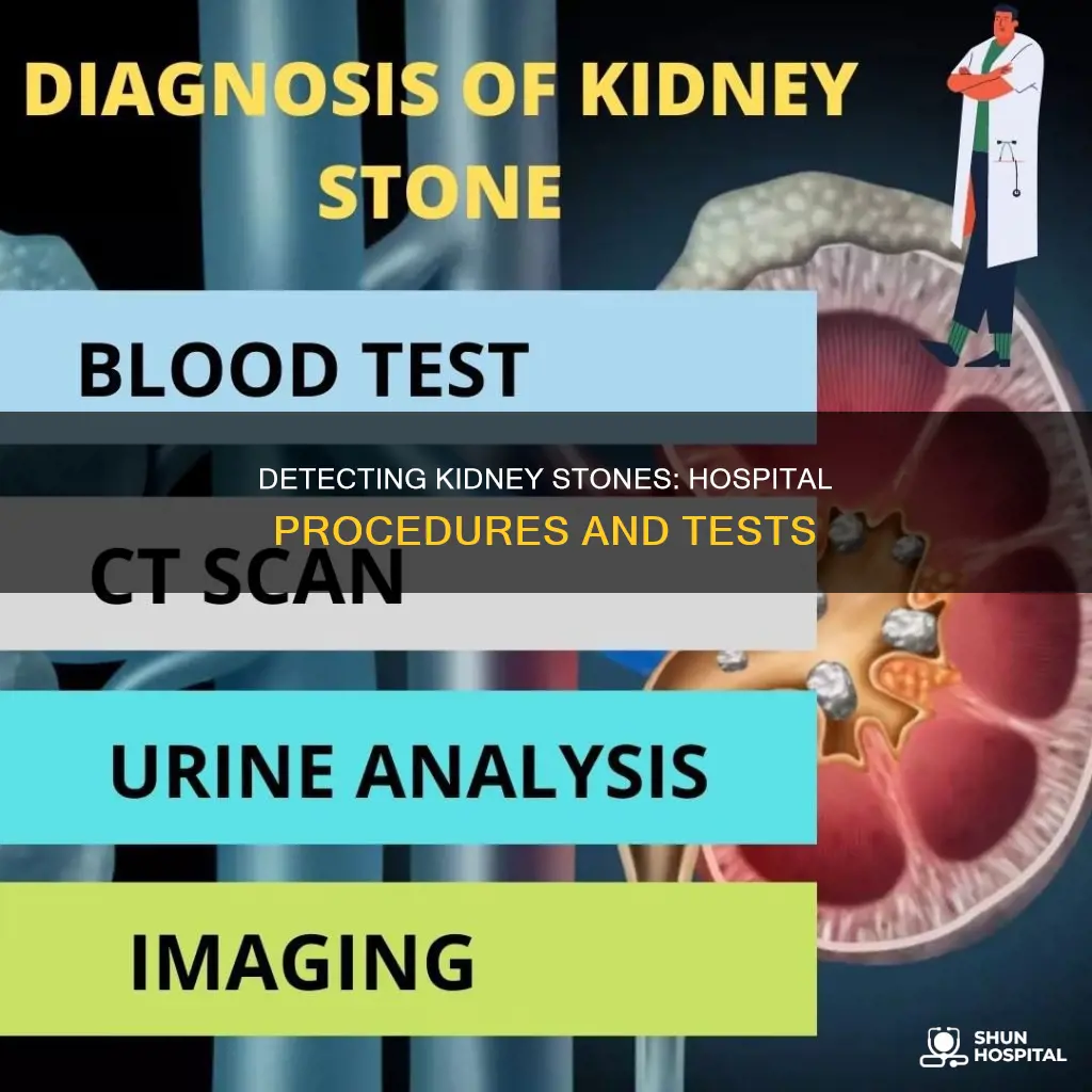 how to detect kidney stones at hospital