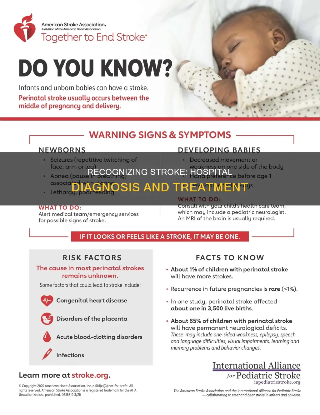 how to diagnose a stroke in hospital