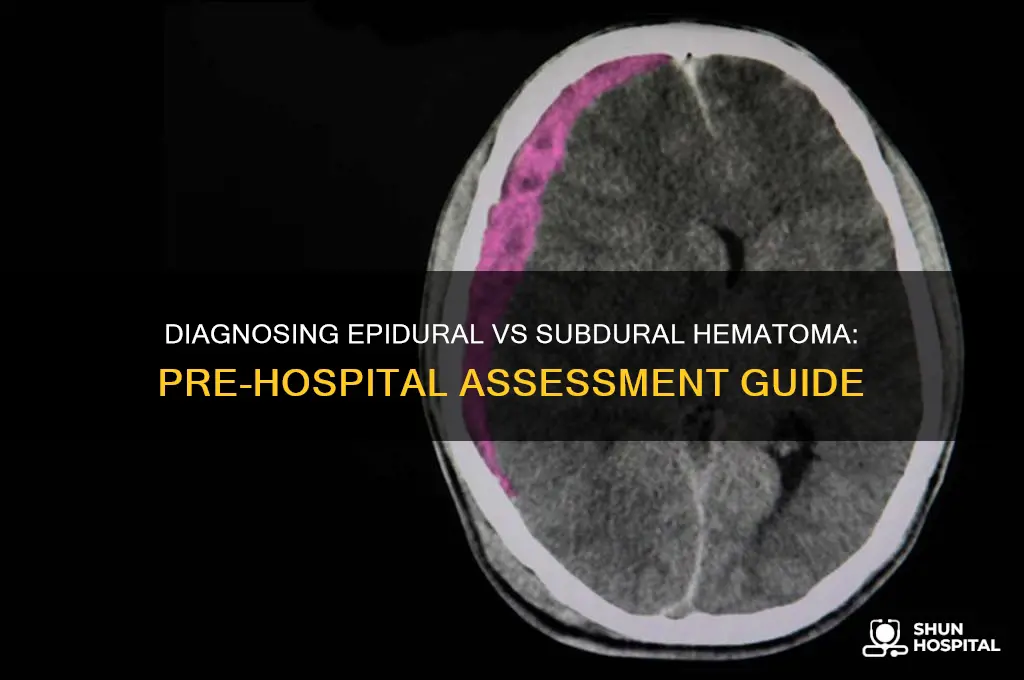 how to diagnose epidural vs subdural hematoma pre hospital