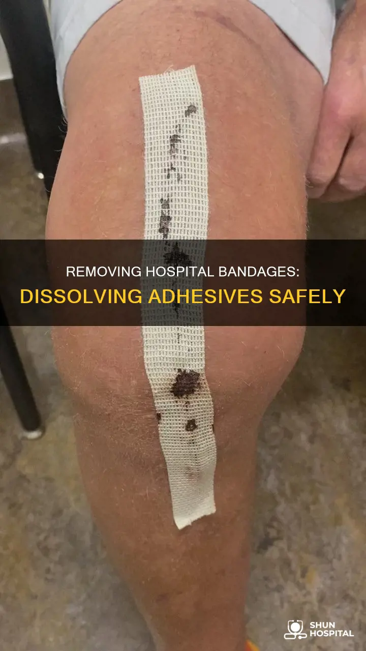 how to dissolve ahesive on hospital bandages