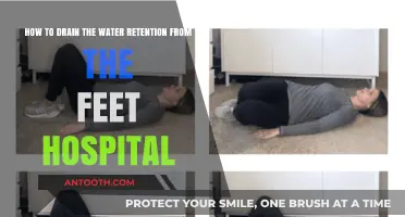 Effective Hospital Techniques to Relieve Foot Water Retention Quickly