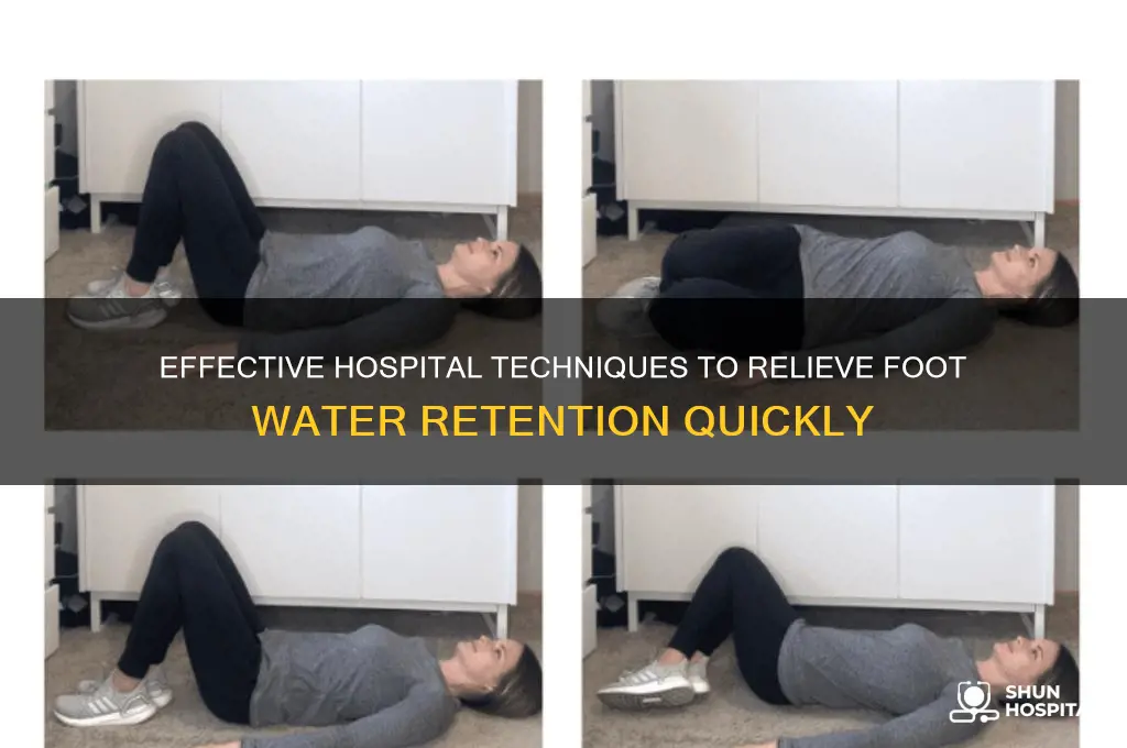 how to drain the water retention from the feet hospital