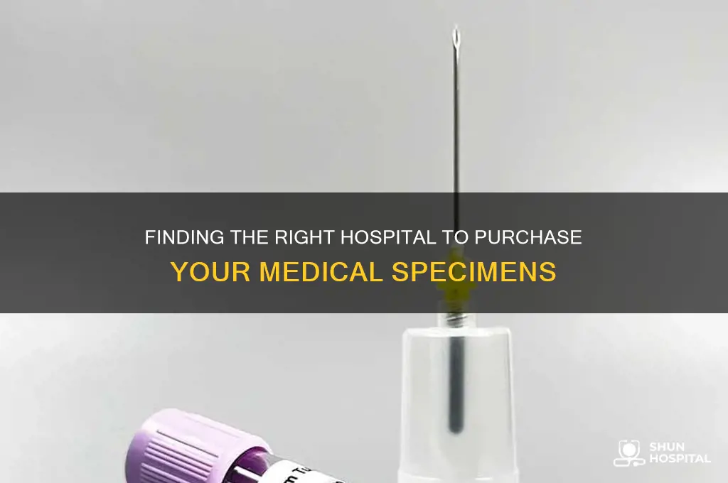 how to find a hospital to buy your specimens