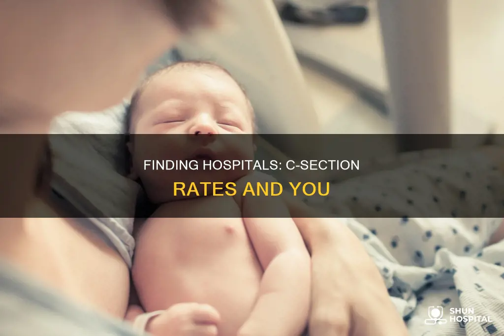 how to find hospital c section rate