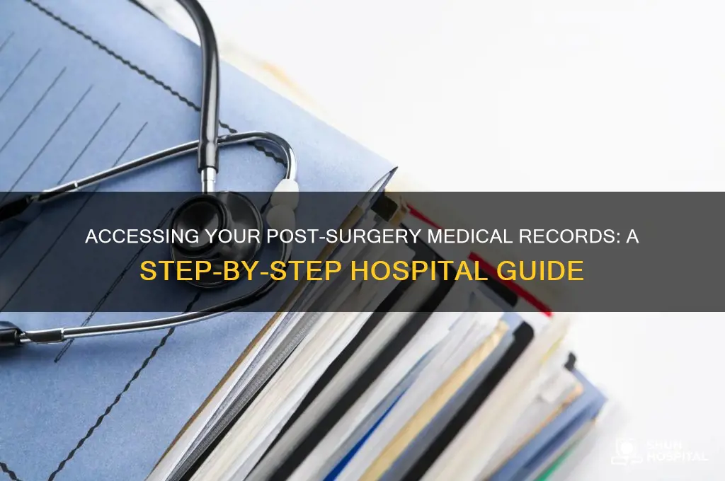 how to gt your post surgery medica records ibly hospital