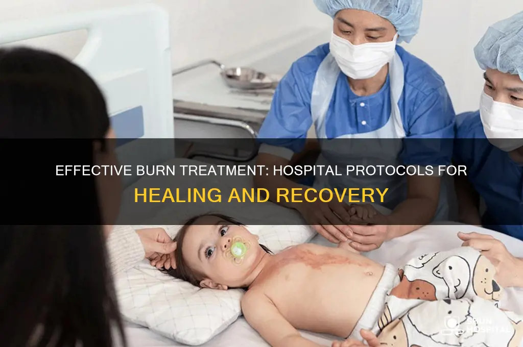 how to hospital treat burns