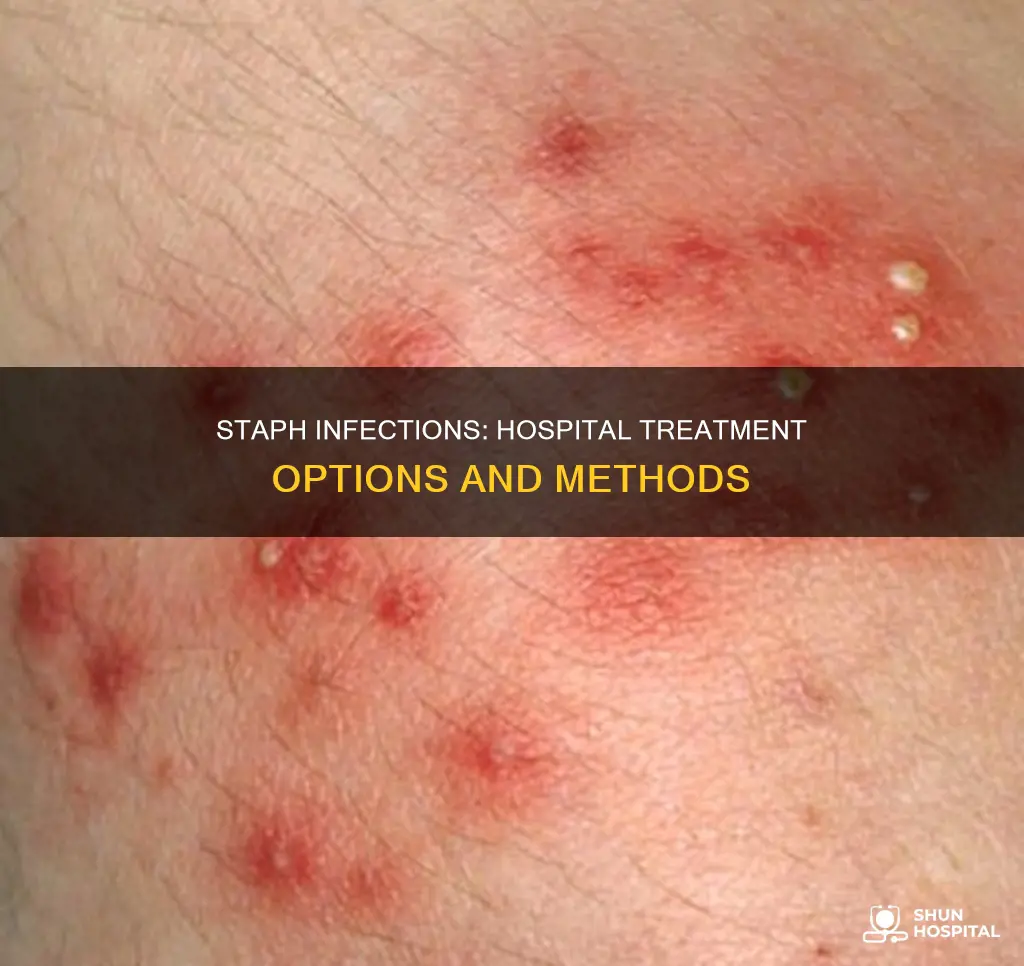 how to hospitals treat sever staph infection