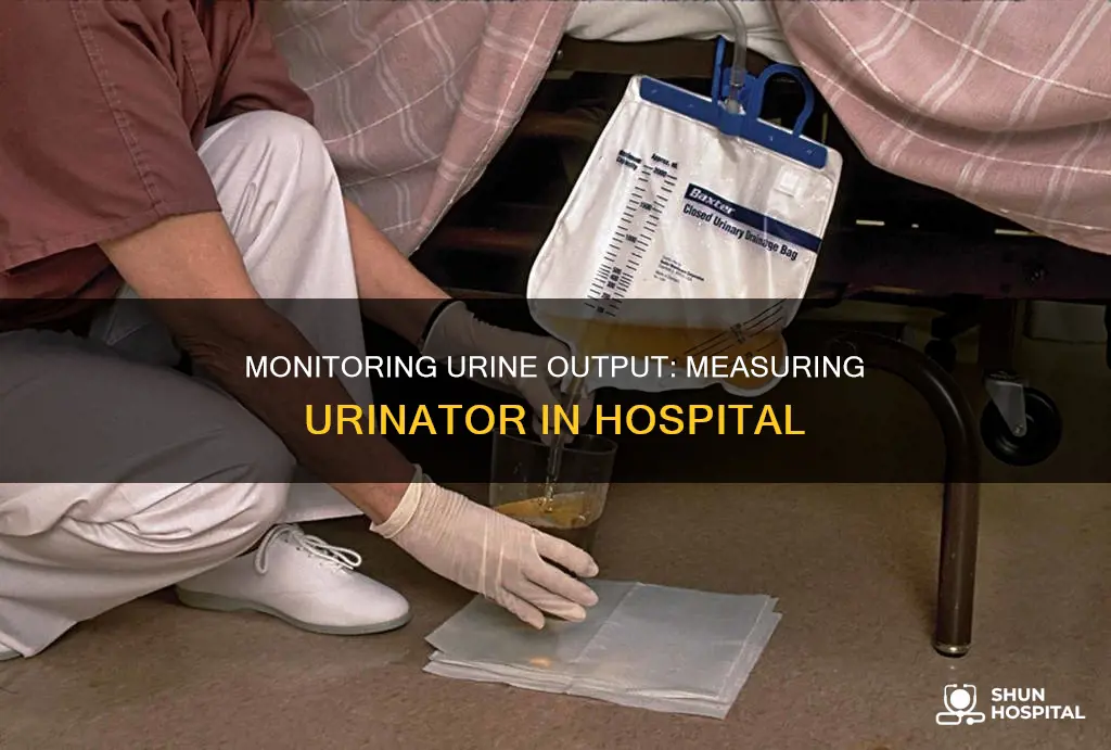 how to measure 8n urinator in hospital