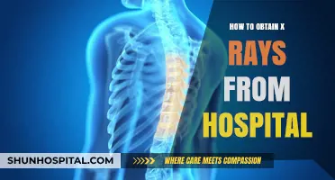 Get Your X-Rays: A Guide to Obtaining Medical Records
