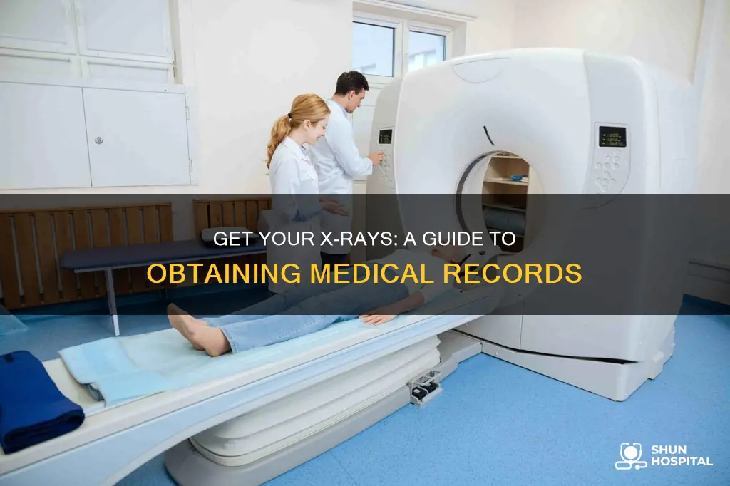 how to obtain x rays from hospital