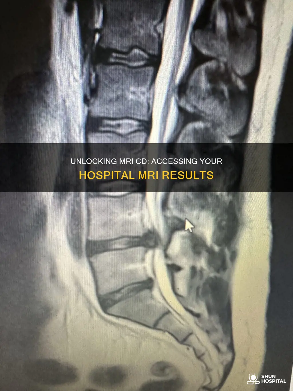 how to open a hospital mri cd