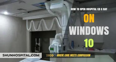 Opening Hospital CD X-Rays on Windows 10: A Step-by-Step Guide