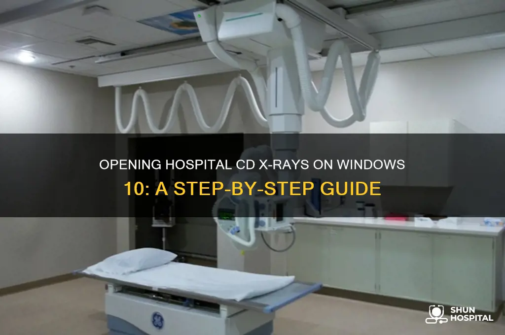 how to open hospital cd x ray on windows 10
