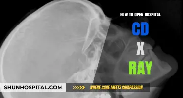 Unlocking X-ray Insights: Accessing Hospital CD Scans