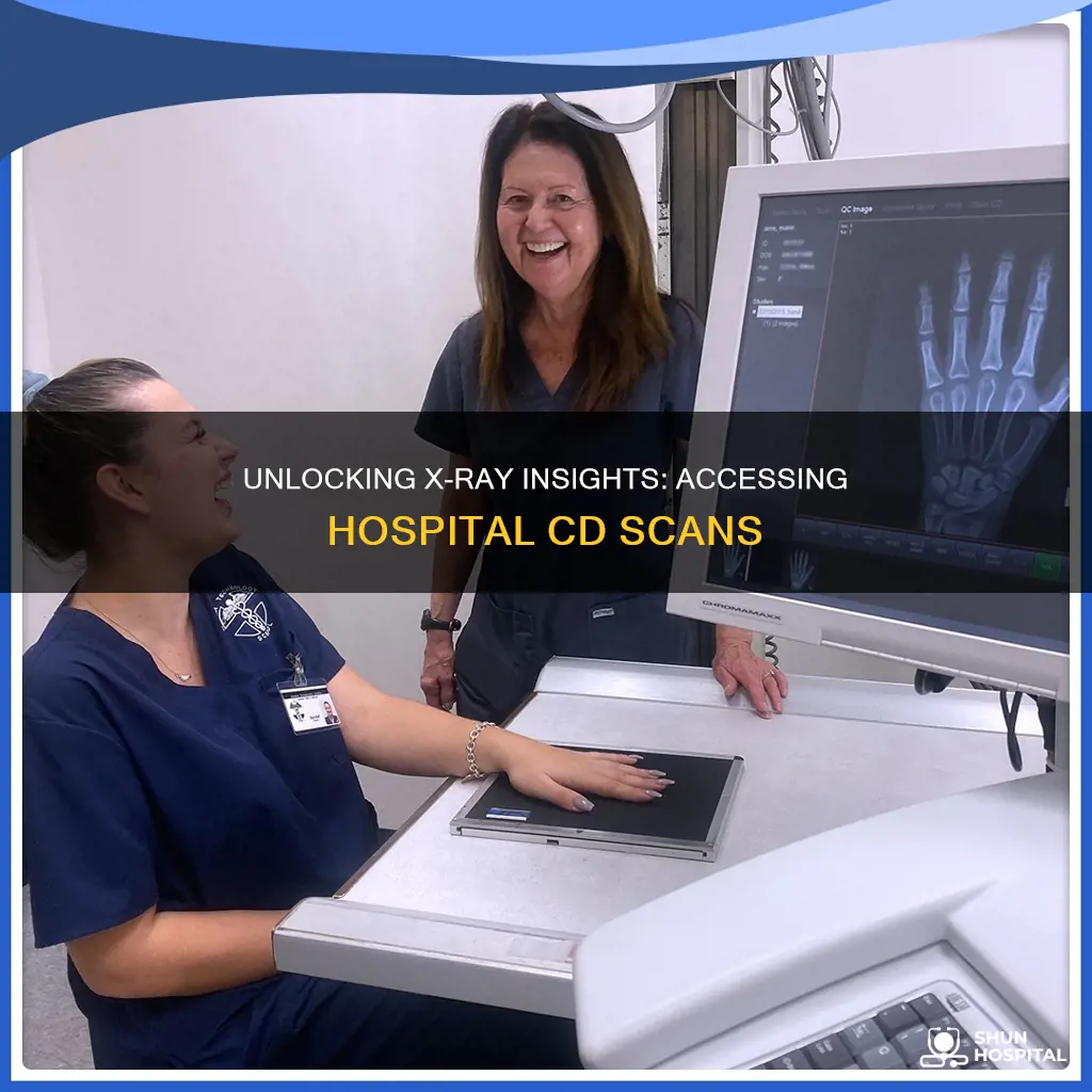 how to open hospital cd x ray