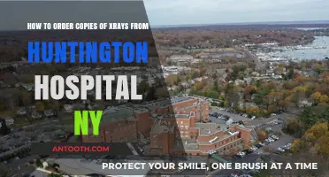 How to Order Copies of X-Rays from Huntington Hospital NY