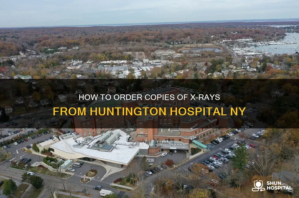 how to order copies of xrays from huntington hospital ny