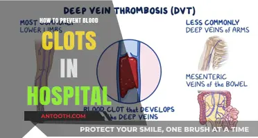 Preventing Blood Clots: Hospital Safety Measures