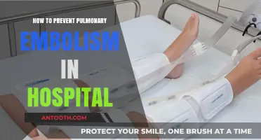 Preventing Pulmonary Embolism: Hospital Strategies