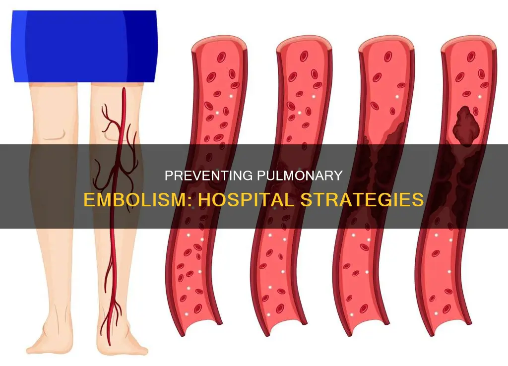 how to prevent pulmonary embolism in hospital