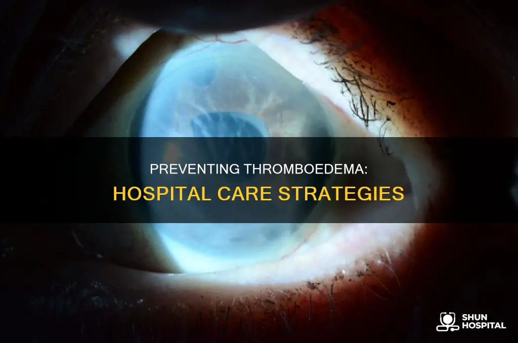 how to prevent thromboedema in the hospital