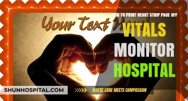 Print Heart Strip from Hospital Vitals Monitor: A Step-by-Step Guide