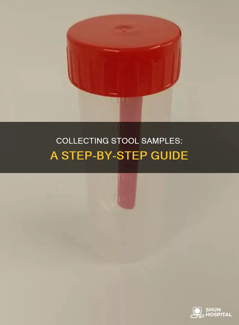 how to provide stool sample to hospital