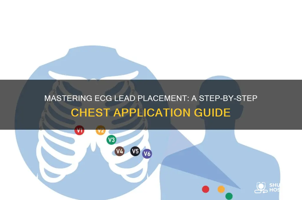 how to put on a hospital ecg leads on chest