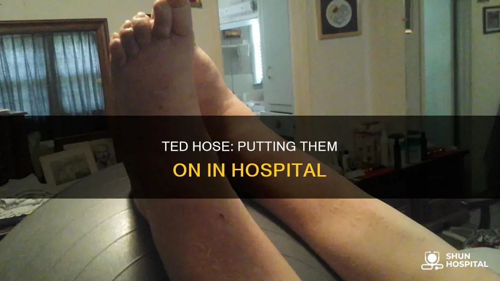 how to put on hospital ted hose
