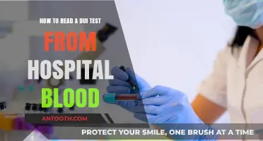 Decoding Hospital Blood DUI Tests: A Step-by-Step Guide