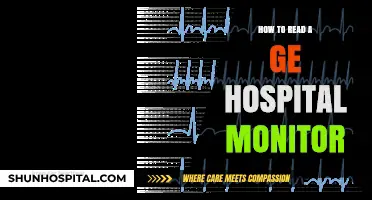 Understanding GE Hospital Monitor Readings