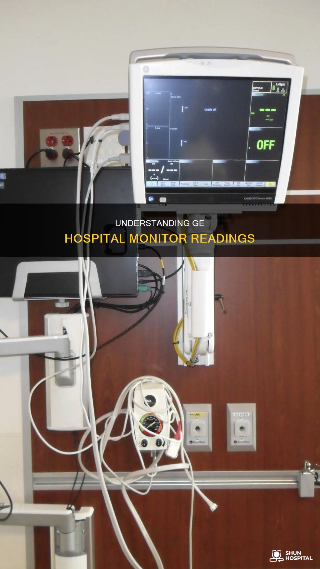 how to read a ge hospital monitor