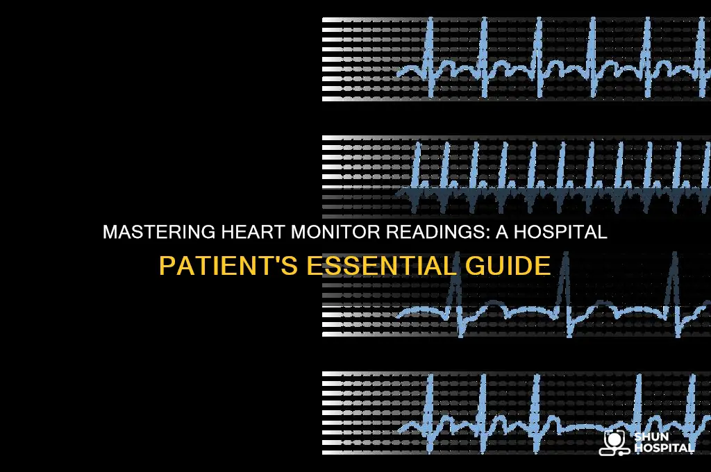 how to read a heart monitor at the hospital