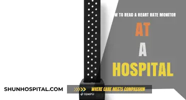 Mastering Heart Rate Monitor Reading: A Hospital Guide for Accuracy