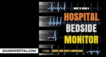 Understanding Hospital Bedside Monitors: A Quick Guide