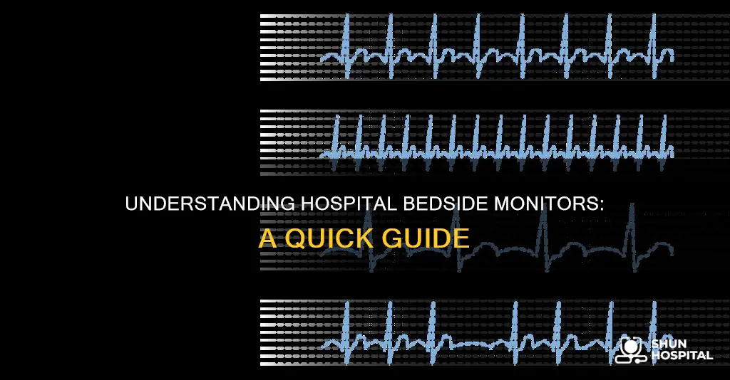 how to read a hospital bedside monitor