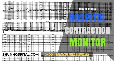 Understanding Hospital Contraction Monitors: A Guide