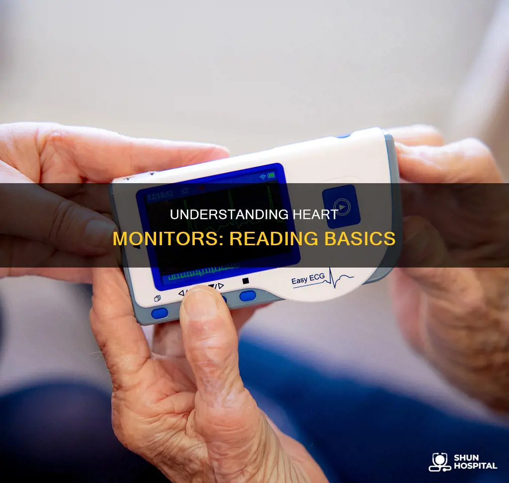 how to read a hospital heart monitor