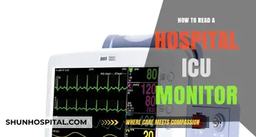 ICU Monitor Reading: A Beginner's Guide