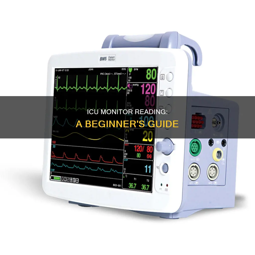 how to read a hospital icu monitor