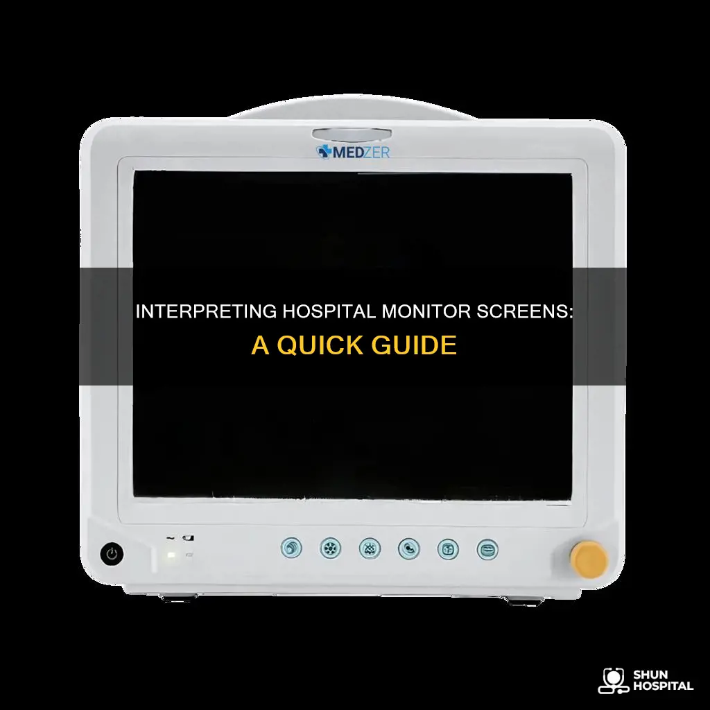 how to read a hospital monitor screen