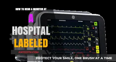 Understanding Hospital Monitor Labels: A Step-by-Step Guide to Reading Them