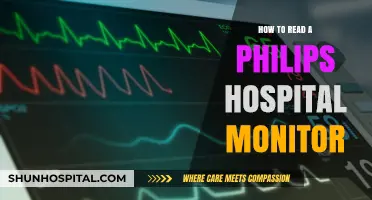 Understanding Philips Hospital Monitor Readings