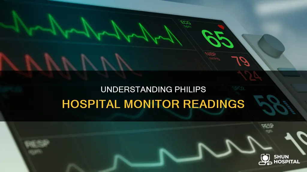 how to read a philips hospital monitor