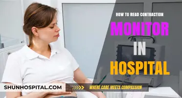 Understanding Hospital Contraction Monitors: A Guide