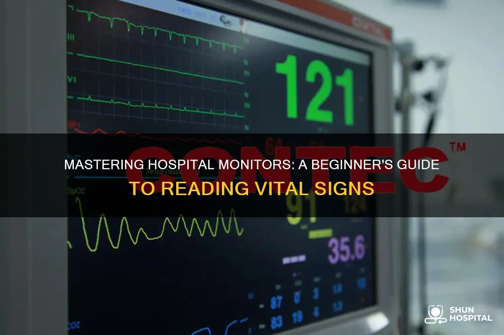 how to read hospital monitor